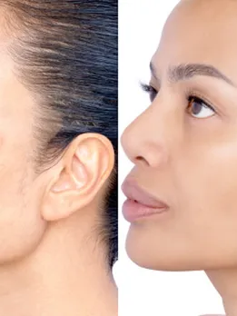 skin pigmentation 3 - unsplash (1)