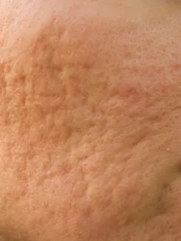 skin pores 1 - unsplash (1)