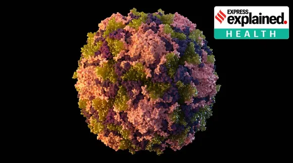 Polio disease outbreak