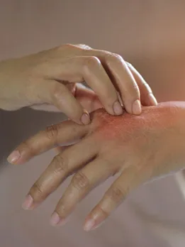 Skin allergy 2 - unsplash (1)