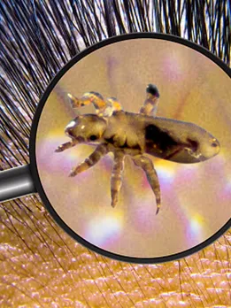 lice - unsplash (1)