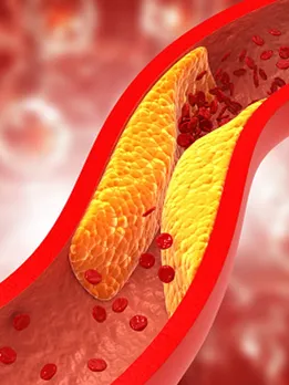 cholesterol 2 - unsplash (1)