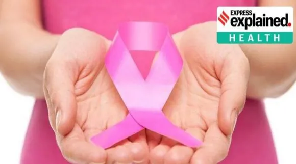 pancreatic cancer, pancreatic cancer vaccine, pancreatic cancer mRNA vaccine, mRNA vaccine, is there a vaccine for pancreatic cancer