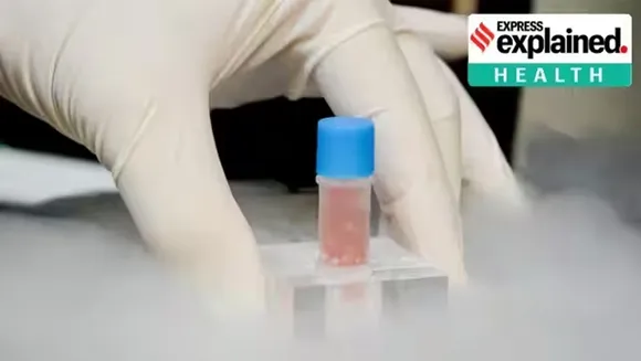 Court allows stem cell therapy for two autistic kids What is this treatment Can it be used to treat autism