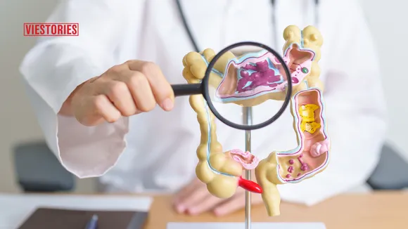 Gastroenterologists in Jabalpur