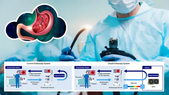 Cloud Endoscopy