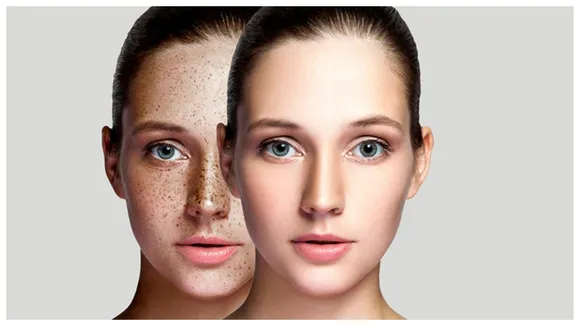 Dark Spots
