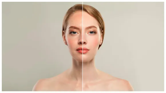 Uneven Skin Tone