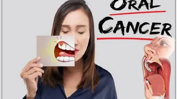 Oral Cancer