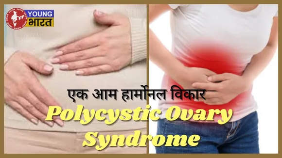 Polycystic Ovary Syndrome