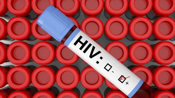 HIV Virus