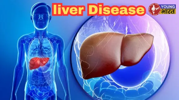 liver Disease imp