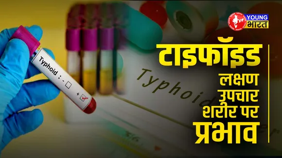 typhoid