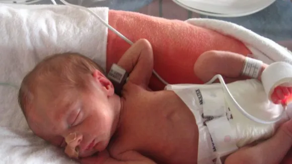 premature birth up