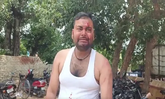 घायल राहुल गुप्ता