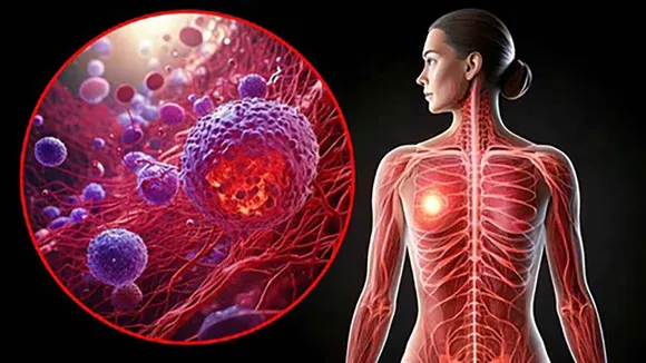 Cancercases