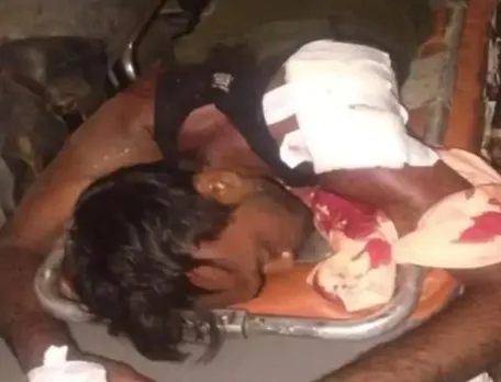 युवक को मारी गोली, हालत गंभीर