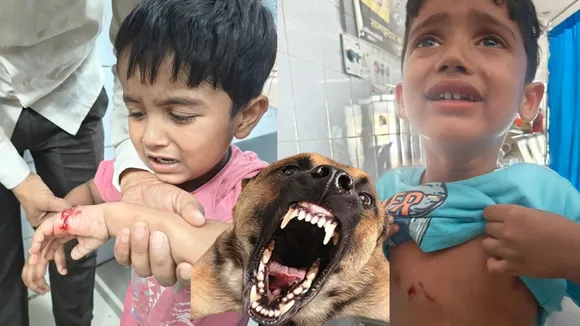 dogs bite lucknow