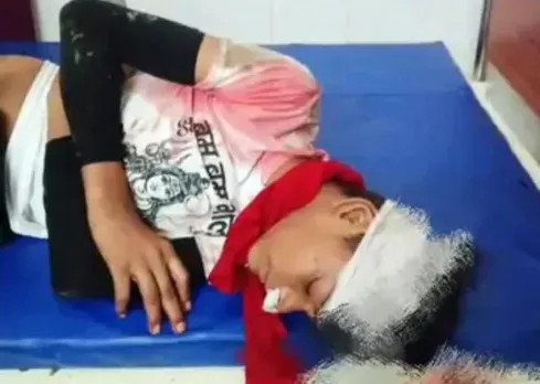 कांवड़ यात्रा के दौरान घायल