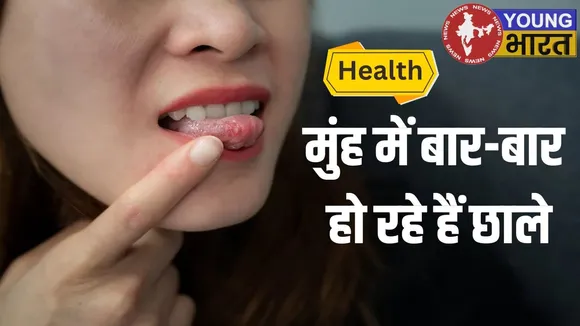 Health Care Mouth care