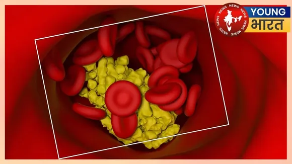Cholesterol Based Spintronics