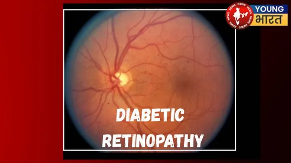 Diabetic Retinopathy