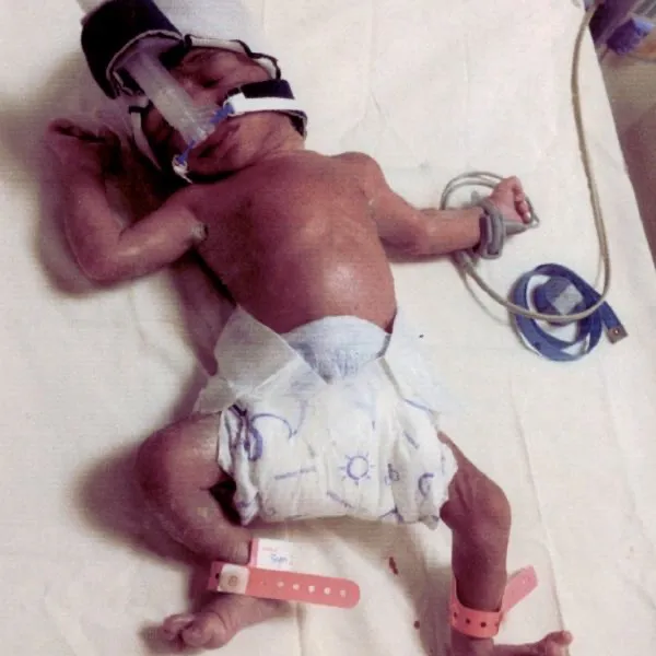 Devarsh during the time of his birth at Fortis Hospital Shalimar Bagh