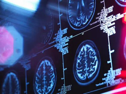 Mystery brain disease spreading in US County, claims two lives