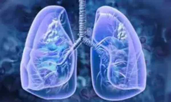 Study: Indians suffering more from post-covid lung damage