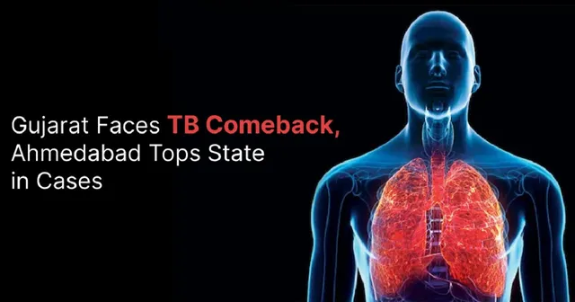 ગુજરાતમાં ટીબીના કેસોમાં ઉછાળો: દર કલાકે 15 નવા દર્દી, અમદાવાદ સૌથી વધુ પ્રભાવિત