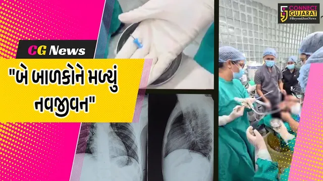 વડોદરા :  સયાજી હોસ્પિટલમાં બે બાળકોની ENT વિભાગે સફળ સર્જરી કરી,પેપર પિન અને સિક્કો સર્જરી કરી બહાર કાઢવામાં આવ્યા