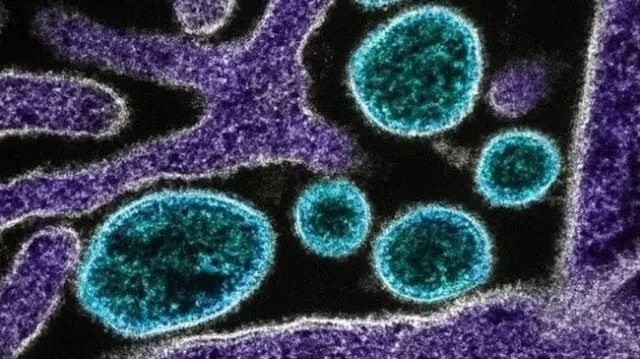 કેરળમાં મગજને અસર કરતા નવા વાયરસની ઓળખ, 15 પૈકી 5 દર્દીના મોત