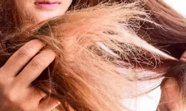 તમારા વાળની સુંદરતા ઘટાડે છે આ સ્પ્લિટ એન્ડ્સ, તો આ ઉપાયો દ્વારા તેને અટકાવો