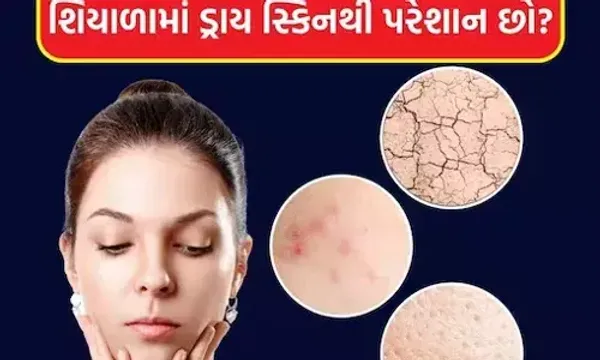 શિયાળામાં રુખીસુકી ત્વચાથી પરેશાન છો? રસોડાની આ વસ્તુઓમાંથી બનાવો ચમત્કારિક ફેસ પેક....