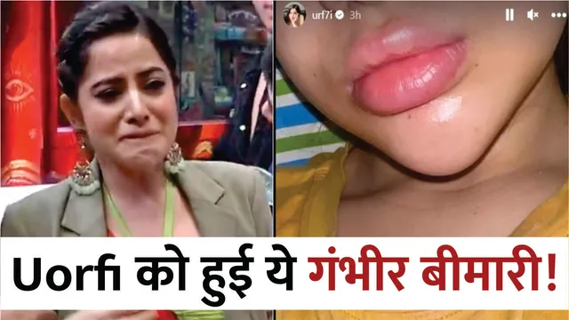 OMG! Actress Uorfi Javed जूझ रही हैं इस गंभीर बीमारी से
