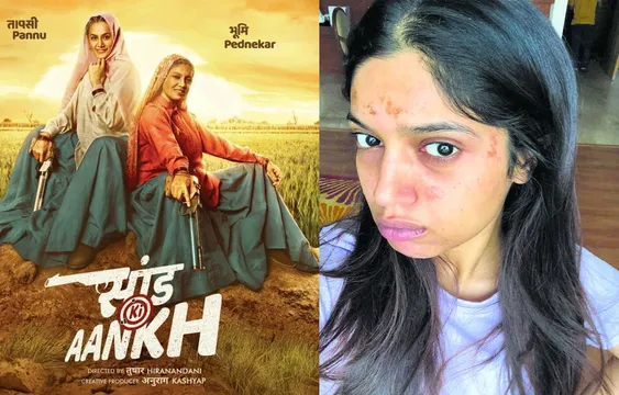 फिल्म 'सांड की आंख' की शूटिंग करते हुए जल गया भूमि पेडणेकर चेहरा