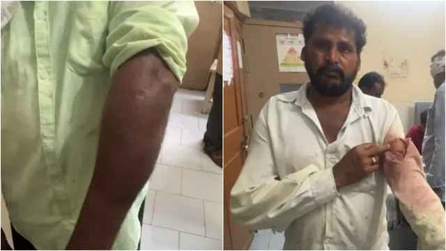 AP News: పల్నాడులో ఇసుక వివాదం..టీడీపీ, వైసీపీ బాహాబాహీ