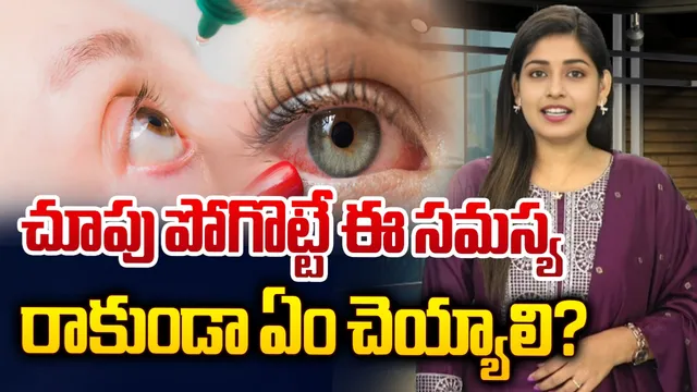EYE Tips: ఈ మిస్టేక్ చేస్తే కంటి చూపు సమస్య.. ఇలా జాగ్రత్త పడండి!