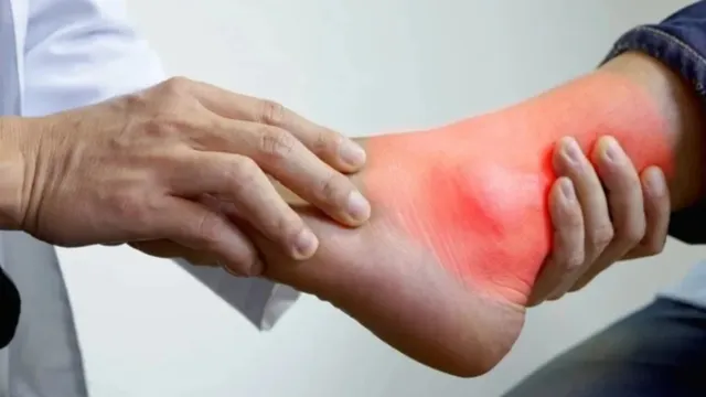 Health: వేప ఆకులతో యూరిక్‌ యాసిడ్ ని ఎలా నియంత్రించాలో తెలుసా!