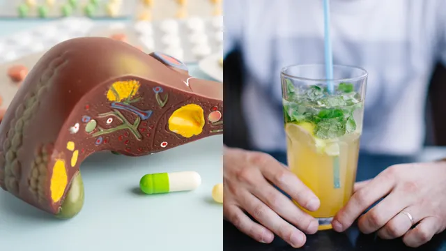 Fatty Liver: నాన్-ఆల్కహాలిక్ ఫ్యాటీ లివర్‌తో ఎంతో ప్రమాదం