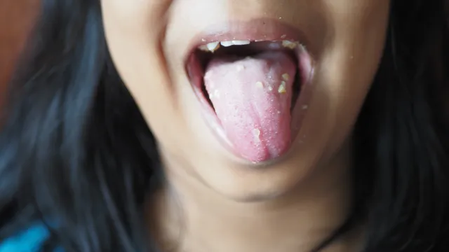 Health Tips: నాలుకను శుభ్రం చేయడం లేదా? మీరు ప్రమాదంలో పడినట్లే