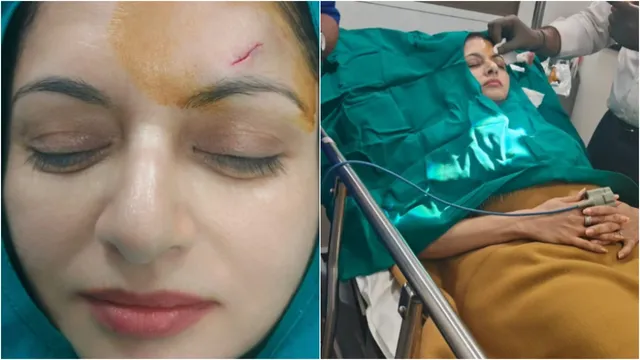Actress Bhagya Shree: షాకింగ్.. ప్రభాస్ తల్లి తలకు గాయం.. 13 కుట్లు వేసిన వైద్యులు