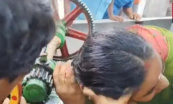 VIDEO VIRAL: తెలంగాణలో ఘోరం.. చెరుకు రసం మిషన్లో ఇరుక్కుకున్న మహిళ జుట్టు