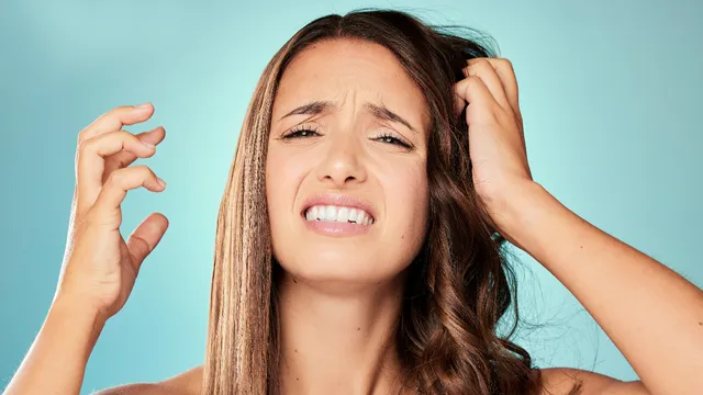 Dandruff: చుండ్రు చిరాకు పెడుతుందా.. ఇలా ఇంట్లోనే సింపుల్‌గా వదిలించుకోండి