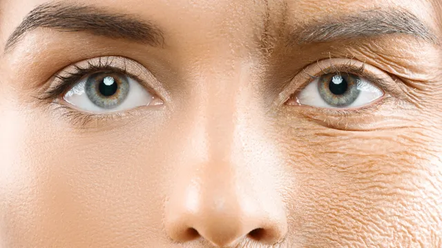 Face Wrinkles: మూడు ఆహారాలు తింటే ముఖంపై ముడతలన్నీ పోతాయి
