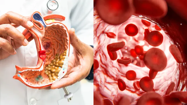 Cholesterol: ఈ నాలుగు  పండ్లతో ఒంట్లో కొలెస్ట్రాల్ ఇట్టే కరిగిపోతుంది!