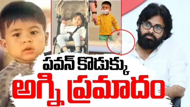 BIG BREAKING: అగ్ని ప్రమాదంలో పవన్ కుమారుడు.. కాళ్లు, చేతులకు గాయాలు!