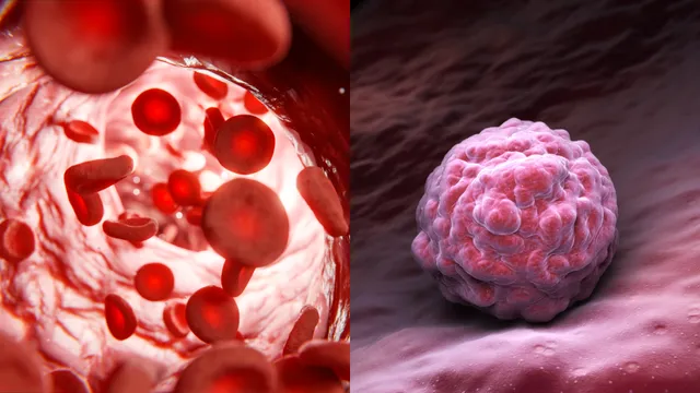 Pancreatic Cancer: ఈ క్యాన్సర్ బ్లడ్ క్యాన్సర్ కంటే ప్రమాదకరం
