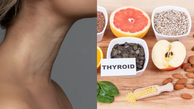 Hyper Thyroidism: థైరాయిడ్ రోగులు తినాల్సిన, తినకూడని ఆహార పదార్థాలు