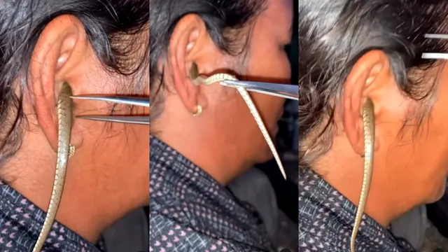 Viral Video: మహిళ చెవిలో దూరిన పాము.. ఒళ్ళు గగుర్పొడిచే వీడియో!